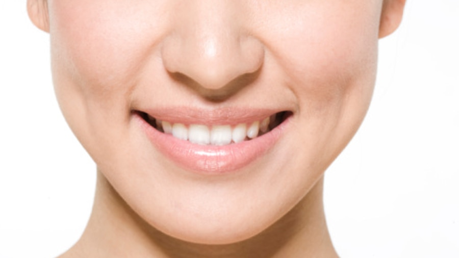 Các Mẹo Làm Trắng Răng Ố Vàng Hiệu Quả Nhất