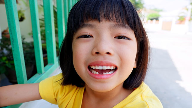 Nhổ răng là gì? Những trường hợp cần tiểu phẫu nhổ răng