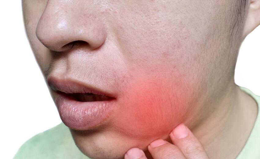 Có thể chườm lạnh để giảm sưng má tại nhà Có thể chườm lạnh để giảm sưng má tại nhà