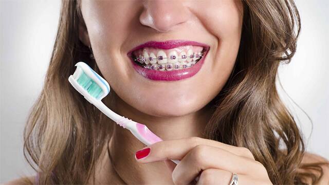 how-many-teeth-do-humans-have - best-toothpaste-for-braces Top 10 kem đánh răng cho người niềng răng tốt nhất 2024
