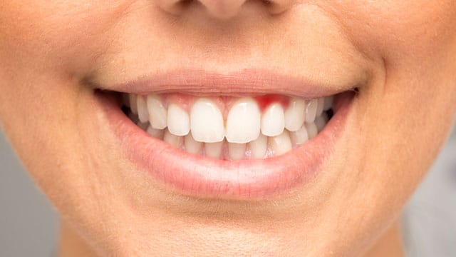 Bệnh lý răng miệng phổ biến