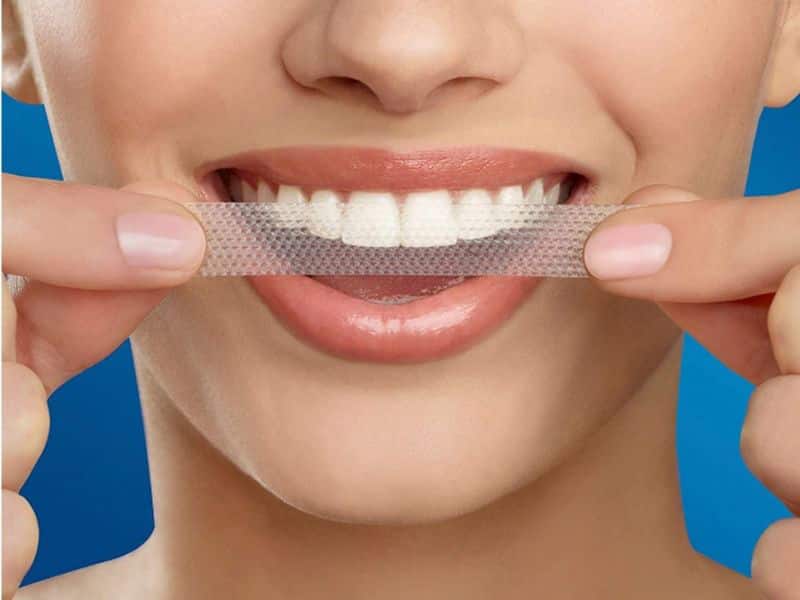 Tẩy trắng răng cấp tốc tại nhà bằng miếng dán trắng răng