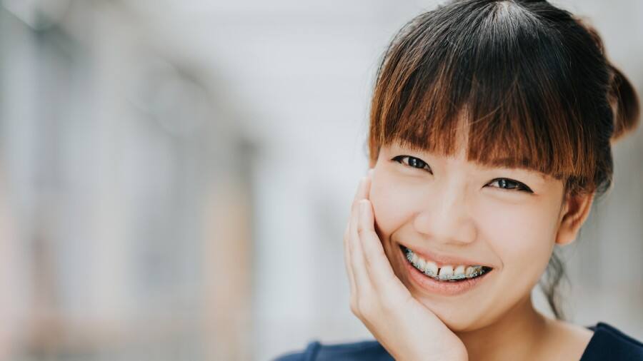 niềng răng có đau không? - colgate