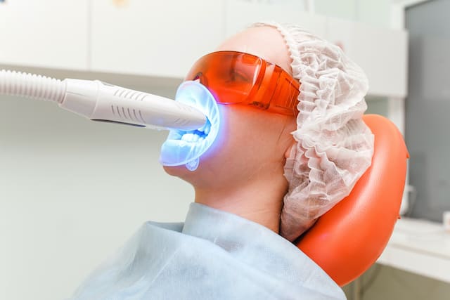 Tẩy trắng răng bằng laser có phải là một lựa chọn phù hợp cho bạn? - colgate