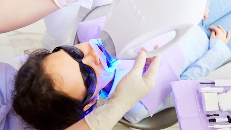 Chi phí tẩy trắng răng bằng laser - colgate Chi phí tẩy trắng răng bằng laser - colgate