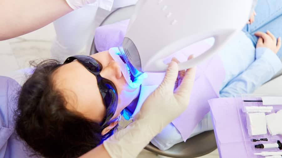 Chi phí tẩy trắng răng bằng laser - colgate