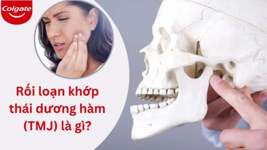 Rối loạn khớp thái dương hàm (TMJ) là gì? Triệu chứng và hướng điều trị