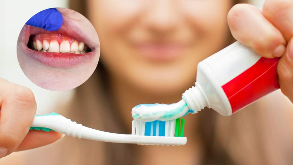 Chọn kem đánh răng tốt cho nướu - colgate