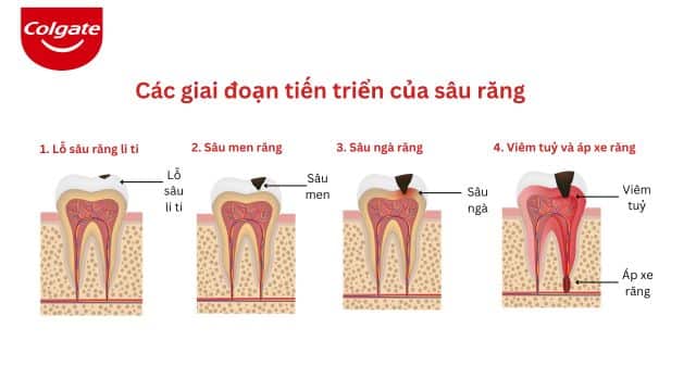 Colgate (640 × 360 px) - 47