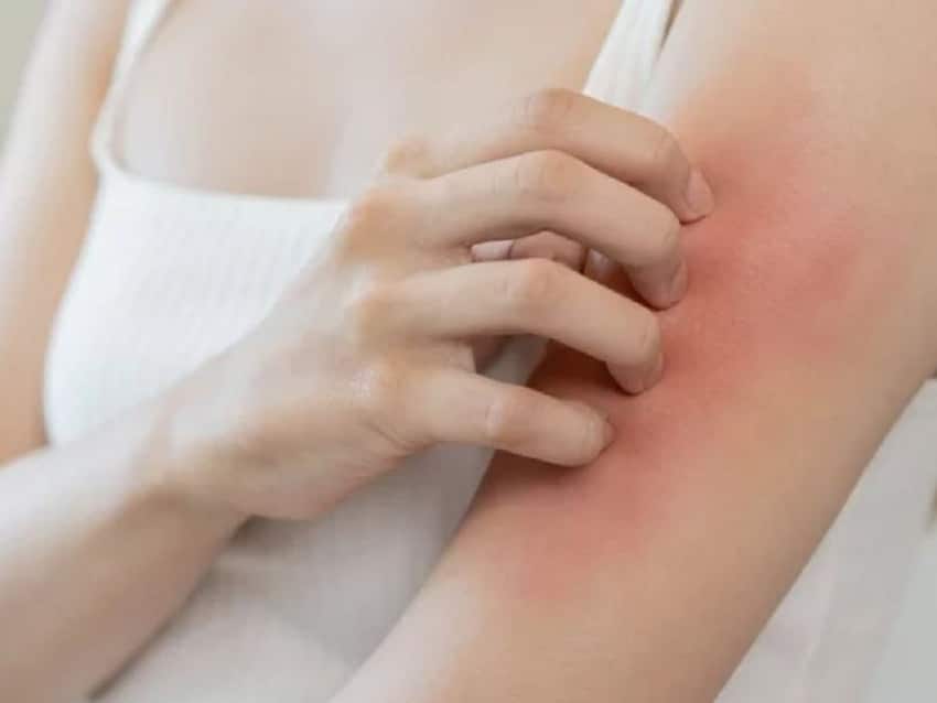 Người bệnh cần chú ý các tác dụng phụ của thuốc