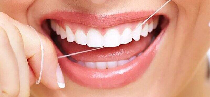 dùng chỉ nha khoa để vệ sinh răng đã được hàn