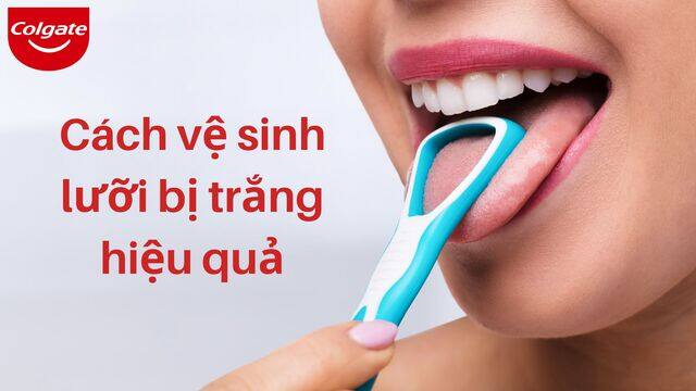 Bạn đã biết làm sạch răng đúng cách?