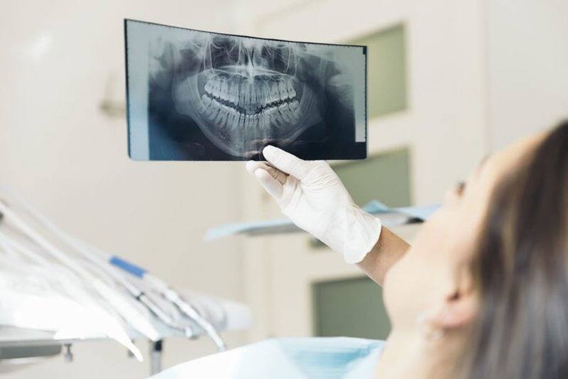 Quy trình chụp x quang răng
