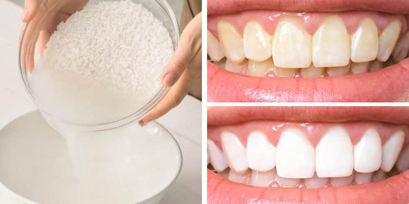 cách làm trắng răng bị vàng bằng nước vo gạo