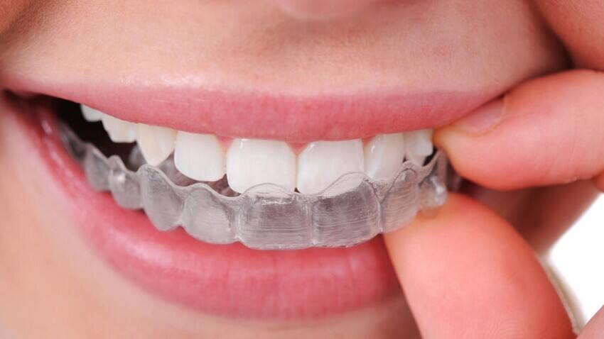 Nghiến răng khi ngủ gây tác hại xấu