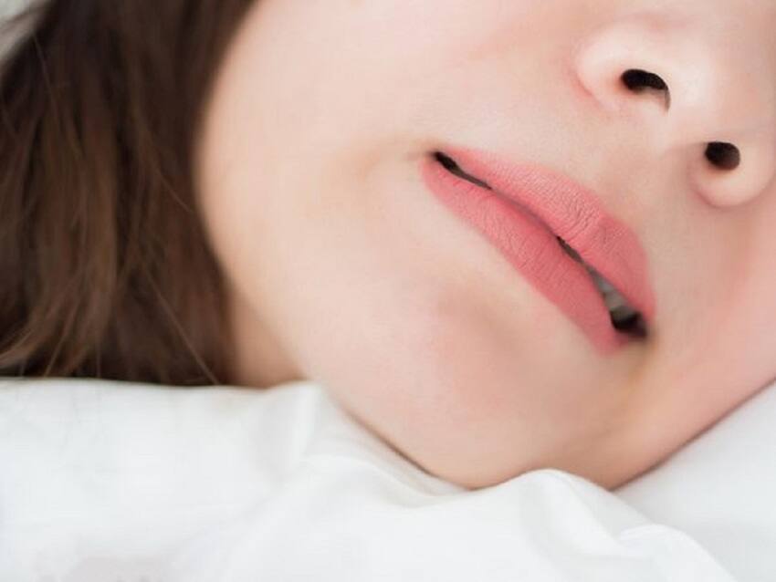 Bệnh nghiến răng khi ngủ