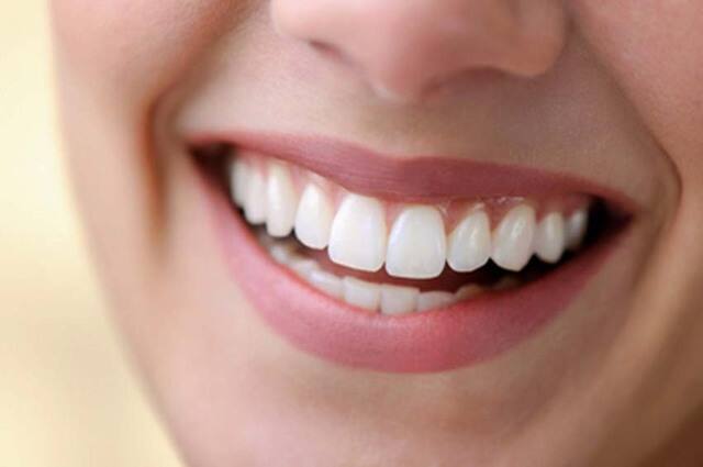 Cách làm răng hết bị ố vàng: sử dụng kem đánh răng, bút làm trắng, chanh, baking soda, liệu pháp nha khoa