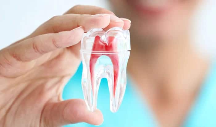Lấy tủy răng không gây đau đớn bằng cách gây tê đúng quy trình và kỹ thuật.