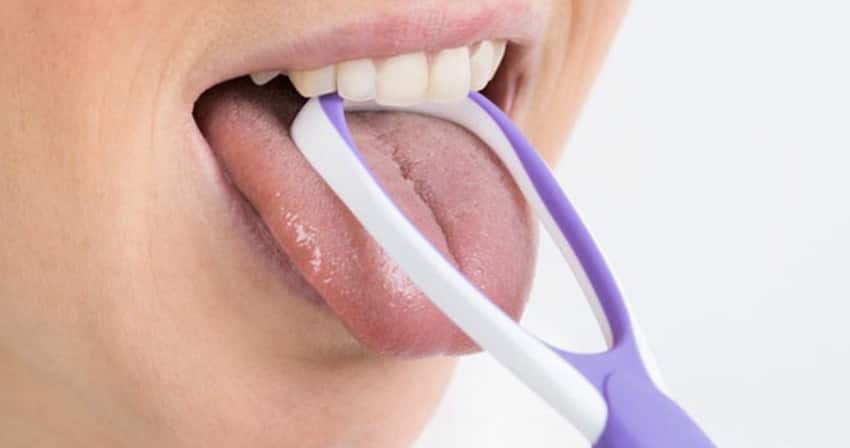 Cách điều trị lưỡi trắng theo chuyên khoa