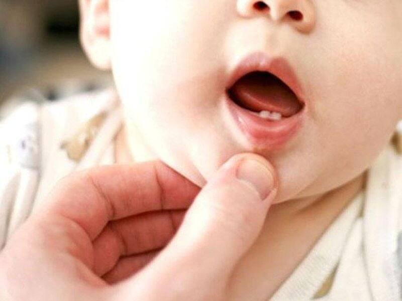 Tác động ảnh hưởng thời gian mọc răng của trẻ