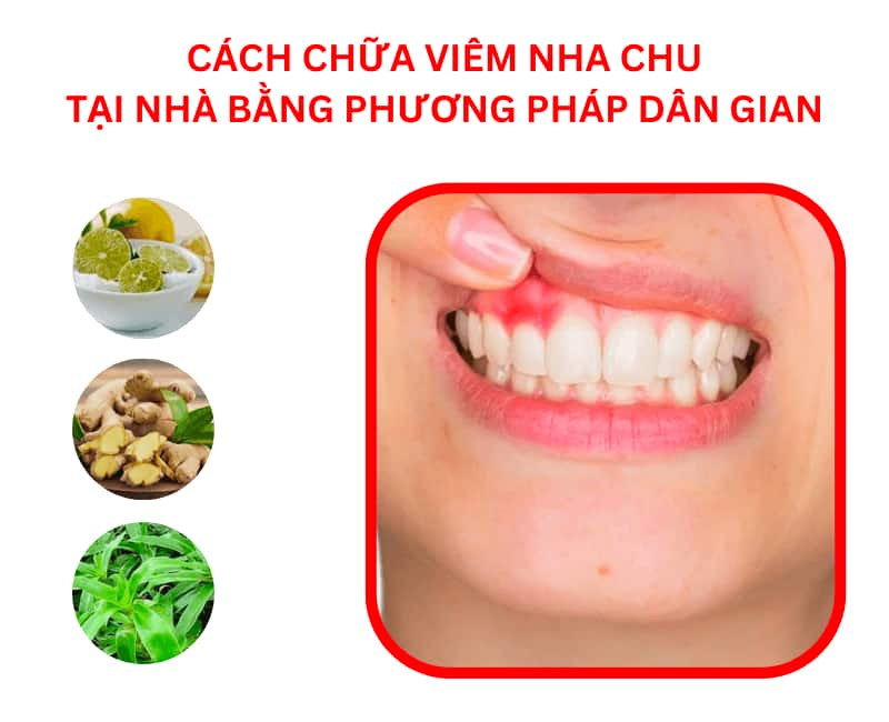 Cách chữa viêm nha chu tại nhà bằng phương pháp dân gian