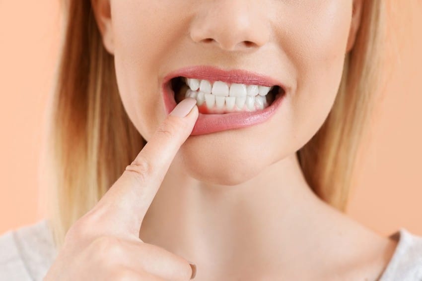 Sưng chân răng hàm dưới gây đau nhức