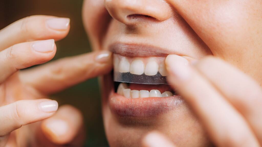 Miếng dán trắng răng có hiệu quả không? - colgate
