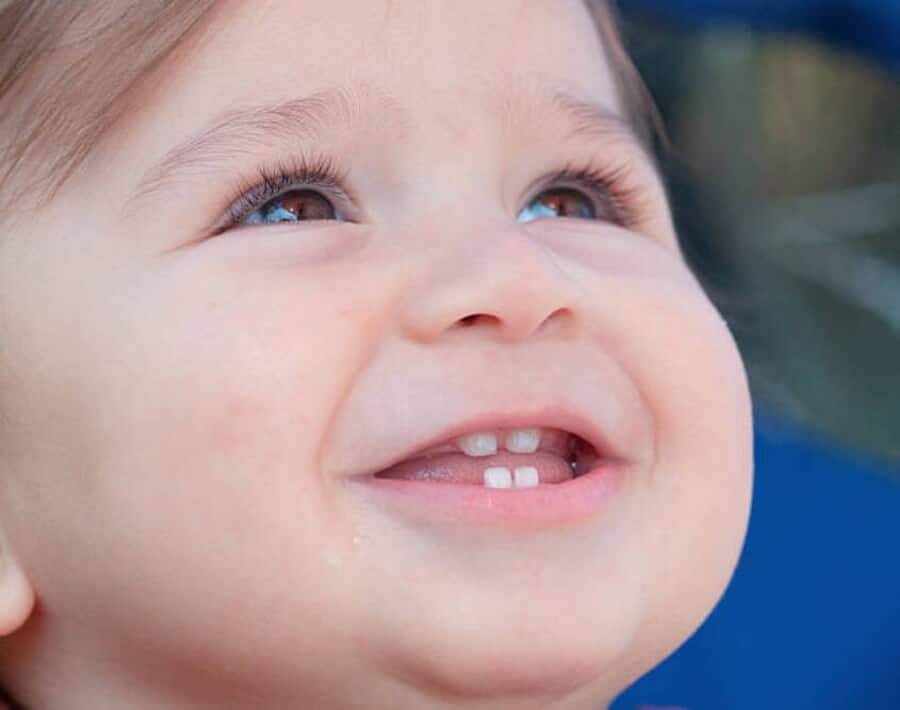 Trẻ mọc răng thường có biểu hiện sốt nhẹ, cáu gắt, quấy khóc