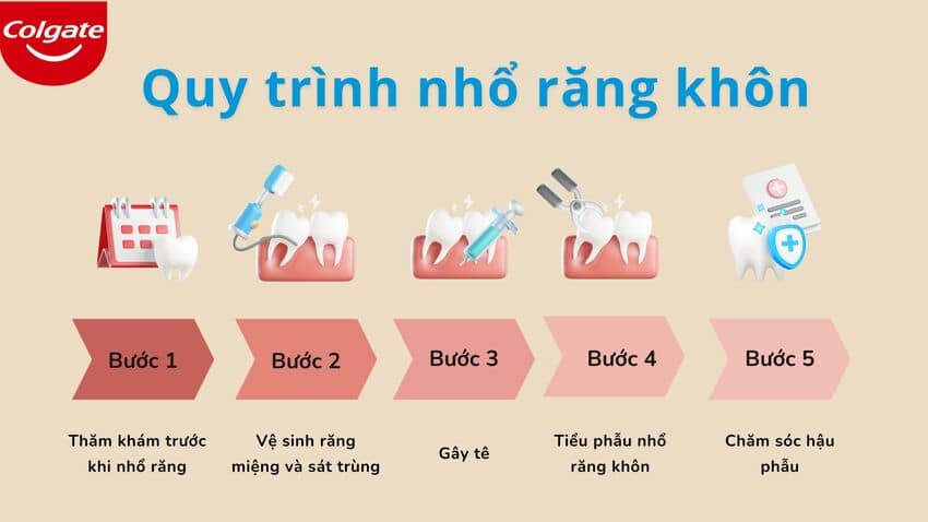 Quy trình nhổ răng khôn tại nha khoa