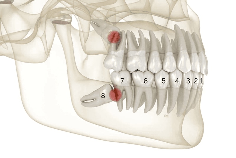 Răng khôn là gì?